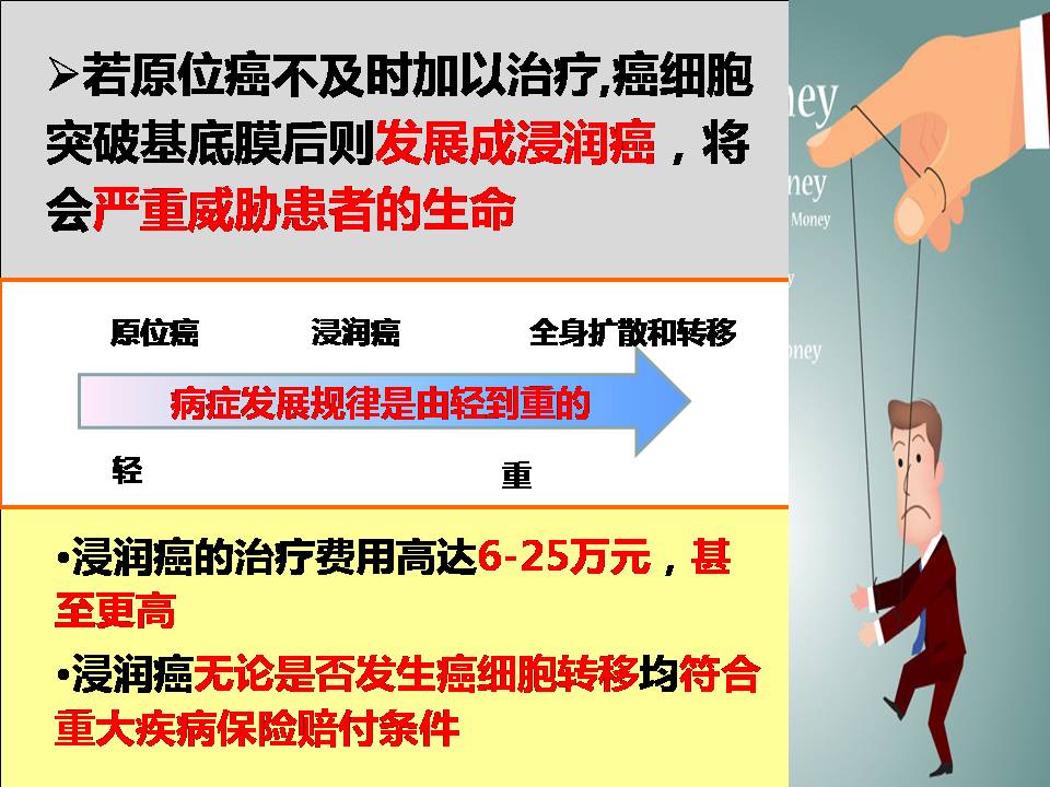 浅谈原位癌