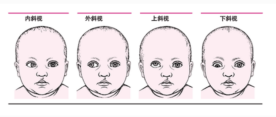 重症肌無力普及手冊